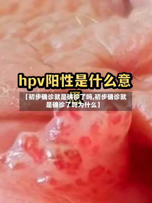 【初步确诊就是确诊了吗,初步确诊就是确诊了吗为什么】-第1张图片