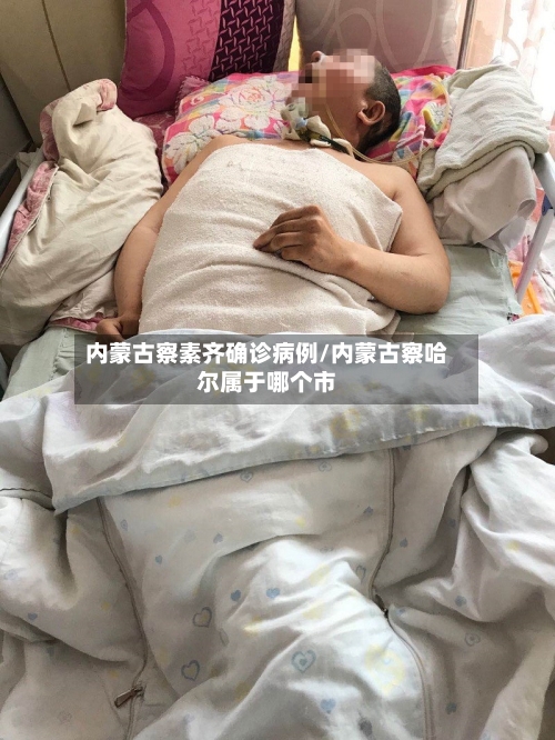 内蒙古察素齐确诊病例/内蒙古察哈尔属于哪个市-第1张图片