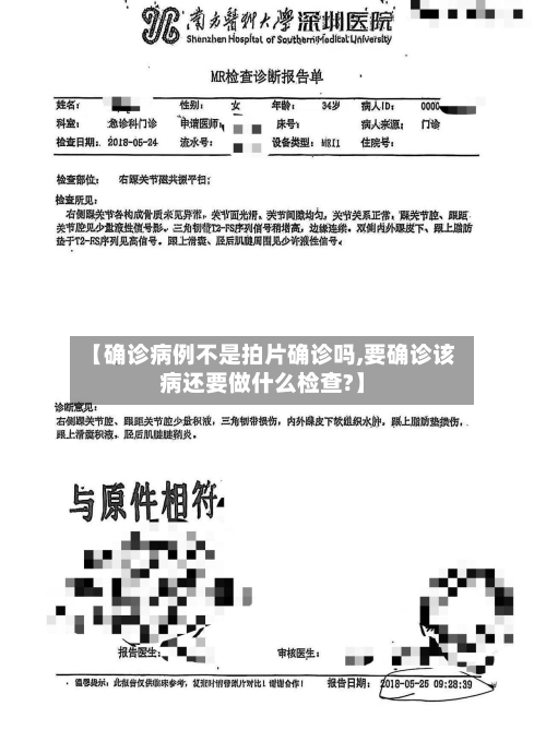 【确诊病例不是拍片确诊吗,要确诊该病还要做什么检查?】-第1张图片