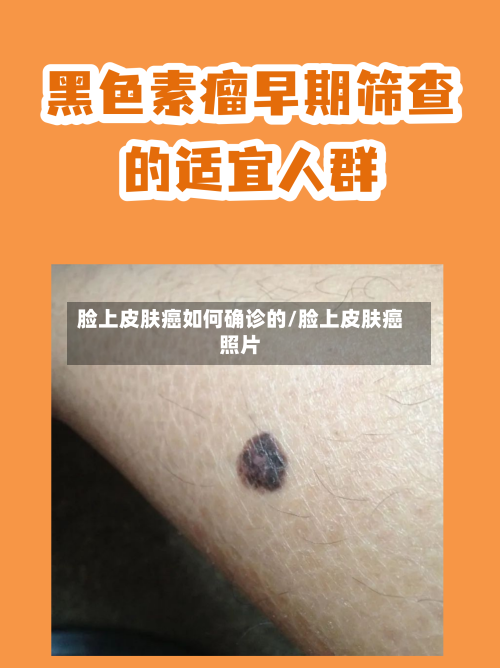 脸上皮肤癌如何确诊的/脸上皮肤癌照片