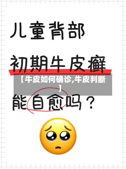 【牛皮如何确诊,牛皮判断】-第2张图片