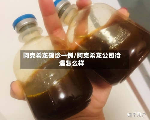 阿克希龙确诊一例/阿克希龙公司待遇怎么样-第2张图片