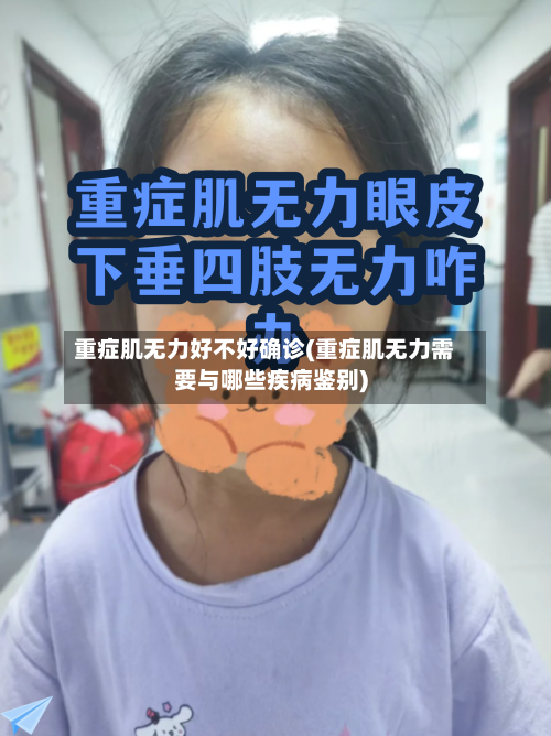 重症肌无力好不好确诊(重症肌无力需要与哪些疾病鉴别)