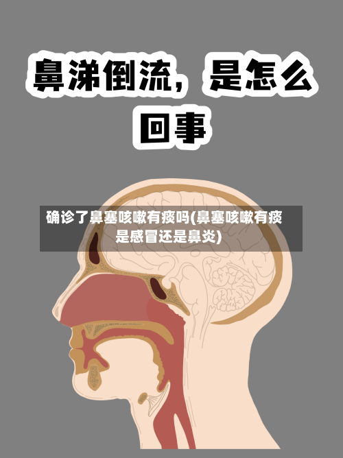 确诊了鼻塞咳嗽有痰吗(鼻塞咳嗽有痰是感冒还是鼻炎)-第2张图片