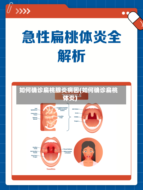 如何确诊扁桃腺炎病因(如何确诊扁桃体炎)-第2张图片