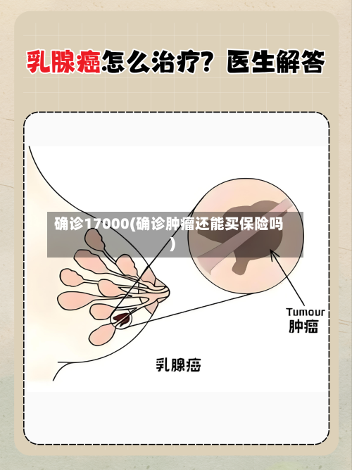 确诊17000(确诊肿瘤还能买保险吗)-第3张图片