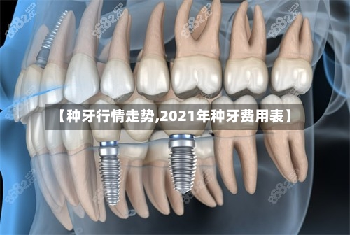 【种牙行情走势,2021年种牙费用表】-第2张图片