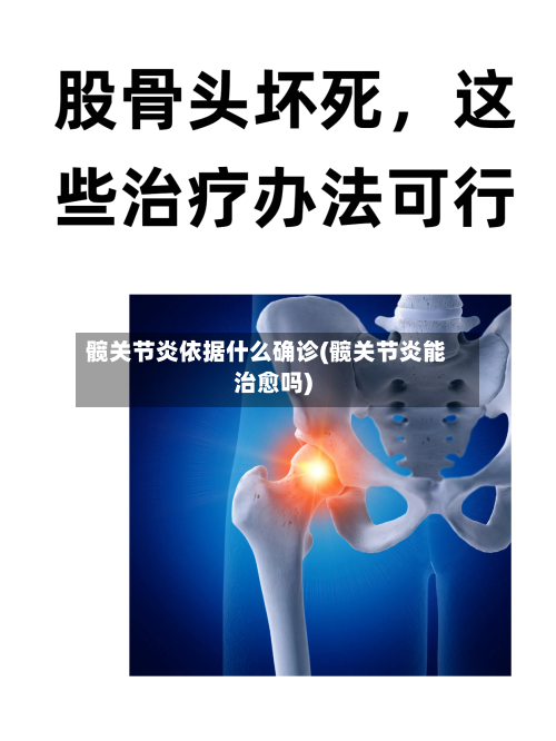 髋关节炎依据什么确诊(髋关节炎能治愈吗)
