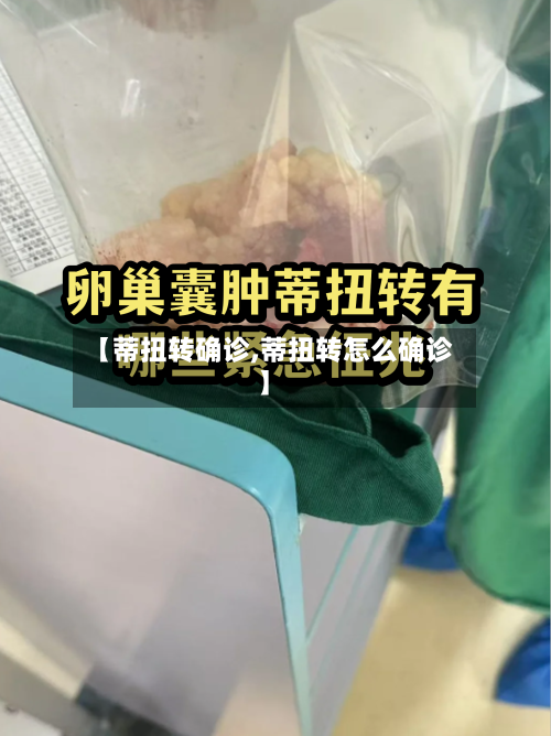 【蒂扭转确诊,蒂扭转怎么确诊】