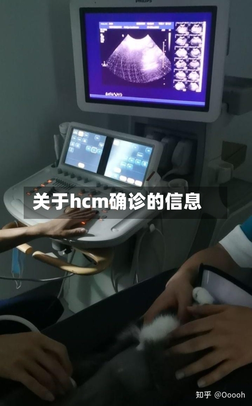 关于hcm确诊的信息