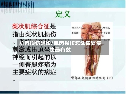肌肉损伤确诊/肌肉损伤怎么恢复最快最有效