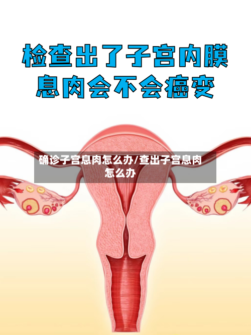 确诊子宫息肉怎么办/查出子宫息肉怎么办-第2张图片