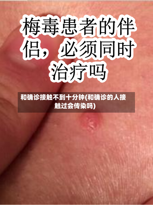 和确诊接触不到十分钟(和确诊的人接触过会传染吗)-第3张图片