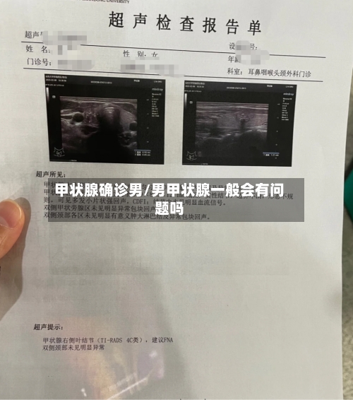 甲状腺确诊男/男甲状腺一般会有问题吗-第2张图片